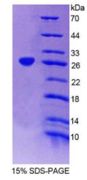 SDS-PAGE (TRIM21-543H).jpg